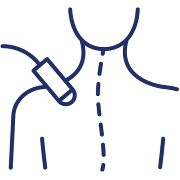 Laser Therapy in Anchorage, AK